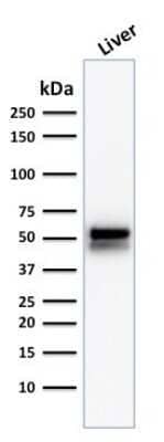 Western Blot: Aldehyde Dehydrogenase 1-A1/ALDH1A1 Antibody (ALDH1A1/1381) - Azide and BSA Free [NBP2-54422] - Western Blot Analysis of human Liver tissue lysate using Aldehyde Dehydrogenase 1-A1/ALDH1A1 Antibody (ALDH1A1/1381).