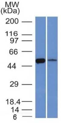 Western Blot: Aldehyde Dehydrogenase 1-A1/ALDH1A1 Antibody (ALDH1A1/1381) [NBP2-53248] - Western Blot of K562 and Lung lysate Aldehyde Dehydrogenase 1-A1/ALDH1A1 Antibody (ALDH1A1/1381).