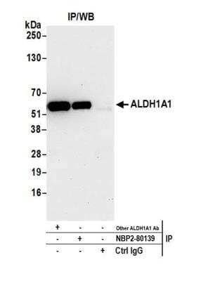 Immunoprecipitation: Aldehyde Dehydrogenase 1-A1/ALDH1A1 Antibody (BLR089G) [NBP2-80139] - Detection of human ALDH1A1 by WB of immunoprecipitates from A-549 lysate. Antibodies: Rabbit anti-ALDH1A1 recombinant monoclonal [BLR089G] (NBP2-80139) and another rabbit anti-ALDH1A1 recombinant monoclonal.