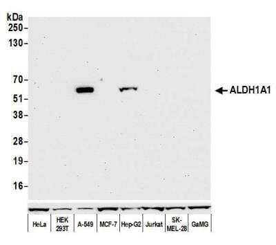 Western Blot: Aldehyde Dehydrogenase 1-A1/ALDH1A1 Antibody (BLR089G) [NBP2-80139] - Detection of human ALDH1A1 by WB of HeLa, HEK293T, MCF-7, Hep-G2, Jurkat, SK-MEL-28, GaMG and A-549 lysate. Antibody: Rabbit anti-ALDH1A1 recombinant monoclonal [BLR089G] (NBP2-80139). Secondary: HRP-conjugated goat anti-rabbit IgG. Lower Panel: Rabbit anti-Cytoskeletal Actin recombinant monoclonal.
