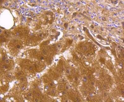 Immunohistochemistry-Paraffin: Aldehyde Dehydrogenase 1-A1/ALDH1A1 Antibody (SY11-02) [NBP2-67385] - Analysis of paraffin-embedded human liver tissue using anti-ALDH1A1 antibody. Counter stained with hematoxylin.