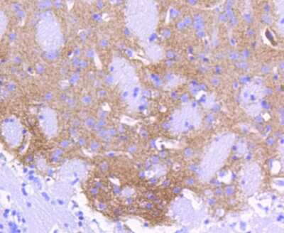 Immunohistochemistry-Paraffin: Aldehyde Dehydrogenase 1-A1/ALDH1A1 Antibody (SY11-02) [NBP2-67385] - Analysis of paraffin-embedded mouse brain tissue using anti-ALDH1A1 antibody. Counter stained with hematoxylin.