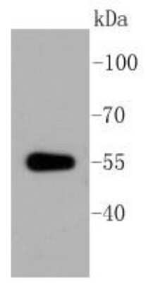 Western Blot: Aldehyde Dehydrogenase 1-A1/ALDH1A1 Antibody (SY11-02) [NBP2-67385] - Analysis of ALDH1A1 on mouse lung lysates using anti-ALDH1A1 antibody at 1/1,000 dilution.