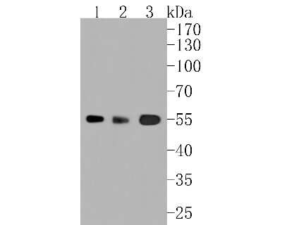 Western Blot: Aldehyde Dehydrogenase 1-A1/ALDH1A1 Antibody (SY11-02) [NBP2-67385] - Western blot analysis of Aldehyde Dehydrogenase 1-A1/ALDH1A1 on different lysates. Proteins were transferred to a PVDF membrane and blocked with 5% BSA in PBS for 1 hour at room temperature. The primary antibody (1/500) was used in 5% BSA at room temperat