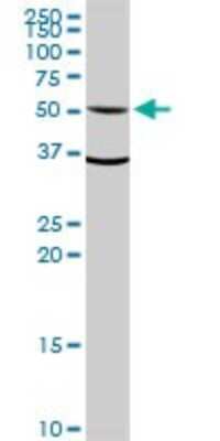 Western Blot: Aldehyde Dehydrogenase 1-A1/ALDH1A1 Antibody [H00000216-D01P] - Analysis of ALDH1A1 expression in HepG2.