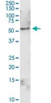 Western Blot: Aldehyde Dehydrogenase 1-A1/ALDH1A1 Antibody [H00000216-D01P] - Analysis of ALDH1A1 expression in K-562.