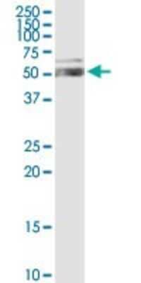 Western Blot: Aldehyde Dehydrogenase 1-A1/ALDH1A1 Antibody [H00000216-D01P] - Analysis of ALDH1A1 expression in human liver.