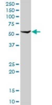 Western Blot: Aldehyde Dehydrogenase 1-A1/ALDH1A1 Antibody [H00000216-D01P] - Analysis of ALDH1A1 expression in mouse lung.