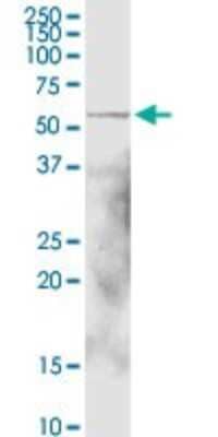 Western Blot: Aldehyde Dehydrogenase 1-A1/ALDH1A1 Antibody [H00000216-D01P] - Analysis of ALDH1A1 expression in mouse liver.