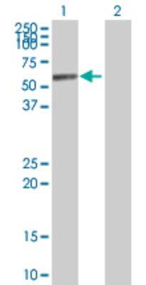 Western Blot: Aldehyde Dehydrogenase 1-A1/ALDH1A1 Antibody [H00000216-D01P] - Analysis of ALDH1A1 expression in transfected 293T cell line by ALDH1A1 polyclonal antibody.Lane 1: ALDH1A1 transfected lysate(54.90 KDa).Lane 2: Non-transfected lysate.