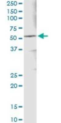 Immunoprecipitation: Aldehyde Dehydrogenase 3-A1/ALDH3A1 Antibody (2G4) [H00000218-M08] - Analysis of ALDH3A1 transfected lysate using anti-ALDH3A1 monoclonal antibody and Protein A Magnetic Bead, and immunoblotted with ALDH3A1 rabbit polyclonal antibody.