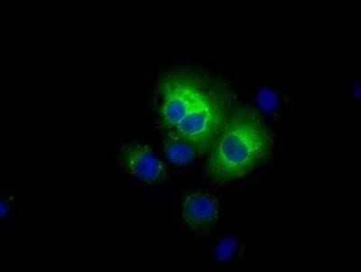 Immunocytochemistry/Immunofluorescence: Aldehyde Dehydrogenase 3-A1/ALDH3A1 Antibody (OTI1B6) - Azide and BSA Free [NBP2-70152] - Staining of COS7 cells transiently transfected by pCMV6-ENTRY ALDH3A1.