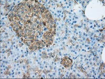 Immunohistochemistry: Aldehyde Dehydrogenase 3-A1/ALDH3A1 Antibody (OTI1B6) - Azide and BSA Free [NBP2-70152] - Staining of paraffin-embedded pancreas tissue using anti-ALDH3A1 mouse monoclonal antibody.