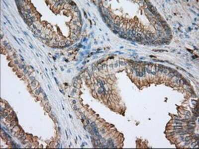 Immunohistochemistry: Aldehyde Dehydrogenase 3-A1/ALDH3A1 Antibody (OTI1B6) - Azide and BSA Free [NBP2-70152] - Staining of paraffin-embedded prostate tissue using anti-ALDH3A1 mouse monoclonal antibody.