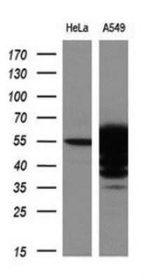 Western Blot: Aldehyde Dehydrogenase 3-A1/ALDH3A1 Antibody (OTI1B6) - Azide and BSA Free [NBP2-70152] - Analysis of extracts (10ug) from 2 different cell lines by using anti-ALDH3A1 monoclonal antibody at 1:200 dilution.