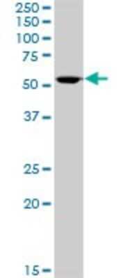 Western Blot: Aldehyde Dehydrogenase 3-A1/ALDH3A1 Antibody [H00000218-B01P] - Analysis of ALDH3A1 expression in A-431.