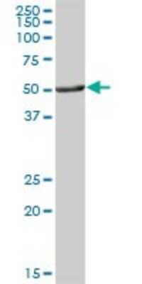 Western Blot: Aldehyde Dehydrogenase 3-A1/ALDH3A1 Antibody [H00000218-B01P] - Analysis of ALDH3A1 expression in human stomach.