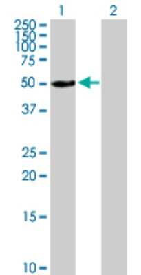 Western Blot: Aldehyde Dehydrogenase 3-A1/ALDH3A1 Antibody [H00000218-B01P] - Analysis of ALDH3A1 expression in transfected 293T cell line by ALDH3A1 polyclonal antibody.  Lane 1: ALDH3A1 transfected lysate(49.83 KDa). Lane 2: Non-transfected lysate.
