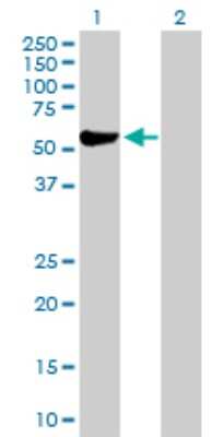 Western Blot: Aldehyde Dehydrogenase 3-A1/ALDH3A1 Antibody [H00000218-D01P] - Analysis of ALDH3A1 expression in transfected 293T cell line by ALDH3A1 polyclonal antibody.Lane 1: ALDH3A1 transfected lysate(50.40 KDa).Lane 2: Non-transfected lysate.