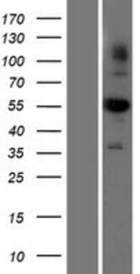 Western Blot: Aldehyde dehydrogenase 5 Overexpression Lysate (Adult Normal) [NBP2-10694] Left-Empty vector transfected control cell lysate (HEK293 cell lysate); Right -Over-expression Lysate for Aldehyde dehydrogenase 5.