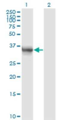 Western Blot: Aldo-keto Reductase 1B10/AKR1B10 Antibody (1A6) [H00057016-M01] - Analysis of AKR1B10 expression in transfected 293T cell line by AKR1B10 monoclonal antibody (M01), clone 1A6.Lane 1: AKR1B10 transfected lysate(36 KDa).Lane 2: Non-transfected lysate.