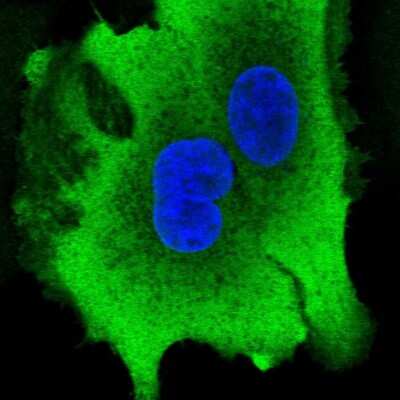 Immunocytochemistry/Immunofluorescence: Aldo-keto Reductase 1B10/AKR1B10 Antibody [NBP2-57972] - Staining of human cell line A549 shows localization to plasma membrane & cytosol.