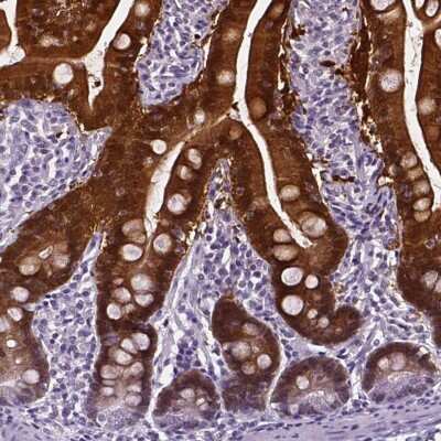 Immunohistochemistry-Paraffin: Aldo-keto Reductase 1B10/AKR1B10 Antibody [NBP1-89161] - Staining of human small intestine shows strong cytoplasmic, nuclear and membranous positivity in glandular cells.