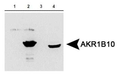 Western Blot: Aldo-keto Reductase 1B10/AKR1B10 Antibody [NBP1-44998] - AKR1B10 expression in 1) aldose reductase (AR) protein, 2) AKR1B10 protein, 3) 293T cells expressing AR and 4) HCT-8 cells expressing AKR1B10. Image courtesy of the laboratory of Dr. Deliang Cao at Southern Illinois University School of Medicine.
