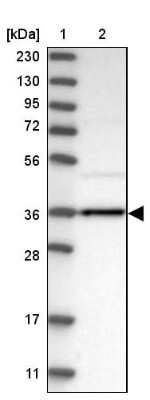 Western Blot: Aldo-keto Reductase 1B10/AKR1B10 Antibody [NBP1-89161] - Lane 1: Marker  [kDa] 230, 130, 95, 72, 56, 36, 28, 17, 11.  Lane 2: Human cell line RT-28