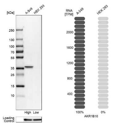 Western Blot: Aldo-keto Reductase 1B10/AKR1B10 Antibody [NBP1-89161] - Analysis in human cell lines A-549 and HEK293 using anti-AKR1B10 antibody. Corresponding AKR1B10 RNA-seq data are presented for the same cell lines. Loading control: anti-HSP90B1.