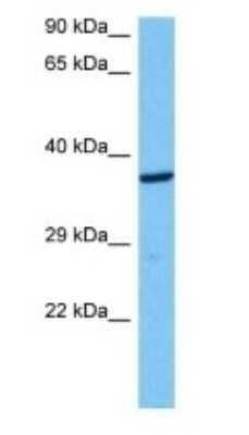 Western Blot: Aldo-keto Reductase 1B10/AKR1B10 Antibody [NBP3-10841] - Western blot analysis of Aldo-keto Reductase 1B10/AKR1B10 in Mouse Skeletal Muscle lysates. Antibody dilution at 1ug/ml