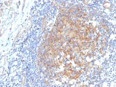 Immunohistochemistry-Paraffin: Aldo-keto Reductase 1C1/AKR1C1 Antibody (CPTC-AKR1C1-2) - Azide and BSA Free [NBP3-08655] - Formalin-fixed, paraffin-embedded human tonsil stained with Aldo-keto Reductase 1C1/AKR1C1 Mouse Monoclonal Antibody (CPTC-Aldo-keto Reductase 1C1/AKR1C1-2).