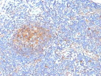 Immunohistochemistry-Paraffin: Aldo-keto Reductase 1C1/AKR1C1 Antibody (CPTC-AKR1C1-2) - Azide and BSA Free [NBP3-08655] - Formalin-fixed, paraffin-embedded human tonsil stained with Aldo-keto Reductase 1C1/AKR1C1 Mouse Monoclonal Antibody (CPTC-Aldo-keto Reductase 1C1/AKR1C1-2).