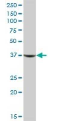 Western Blot: Aldo-keto Reductase 1C1/AKR1C1 Antibody [H00001645-B01P] - Analysis of AKR1C1 expression in human liver.