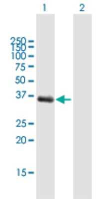 Western Blot: Aldo-keto Reductase 1C1/AKR1C1 Antibody [H00001645-B01P] - Analysis of AKR1C1 expression in transfected 293T cell line by AKR1C1 polyclonal antibody.  Lane 1: AKR1C1 transfected lysate(35.53 KDa). Lane 2: Non-transfected lysate.