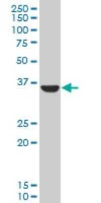 Western Blot: Aldo-keto Reductase 1C3/AKR1C3 Antibody [H00008644-B01P] - Analysis of AKR1C3 expression in human liver.