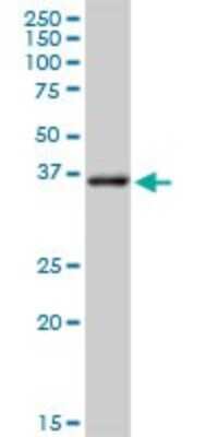 Western Blot: Aldo-keto Reductase 1C3/AKR1C3 Antibody [H00008644-D01P] - Analysis of AKR1C3 expression in human colon.