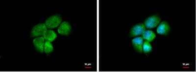 Immunocytochemistry/Immunofluorescence: Aldo-keto Reductase 1C4/AKR1C4 Antibody [NBP1-31429] - Sample: A431 cells were fixed in 4% paraformaldehyde at RT for 15 min. Green: 1C4/AKR1C4 protein stained by 1C4/AKR1C4 antibody diluted at 1:500. Blue: Hoechst 33342 staining.