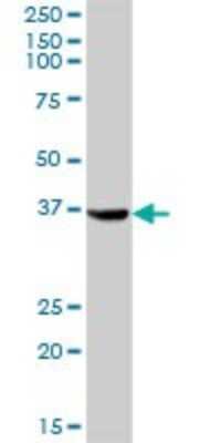 Western Blot: Aldo-keto Reductase 1C4/AKR1C4 Antibody [H00001109-B01P] - Analysis of AKR1C4 expression in human liver.