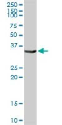 Western Blot: Aldo-keto Reductase 1C4/AKR1C4 Antibody [H00001109-D01P] - Analysis of AKR1C4 expression in human liver.