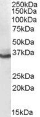 Western Blot: Aldo-keto Reductase 1C4/AKR1C4 Antibody [NB100-40786] -  (0.1ug/ml) staining of human liver lysate (35ug protein in RIPA buffer). Primary incubation was 1 hour. Detected by chemiluminescence.