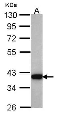 Western Blot: Aldo-keto Reductase 1C4/AKR1C4 Antibody [NBP1-31429] - Sample (30 ug of whole cell lysate) A: Hela 10% SDS PAGE 1C4/AKR1C4 antibody, antibody diluted at 1:1000.