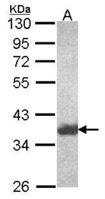 Western Blot: Aldo-keto Reductase 1C4/AKR1C4 Antibody [NBP2-14989] - Sample (30 ug of whole cell lysate) A: Hela 10% SDS PAGE HSD3a antibody, antibody diluted at 1:1000.