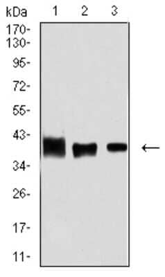 Western Blot: Aldolase A Antibody (1C5B2) [NBP2-61844] - Analysis using ALDOA mouse mAb against MCF-7 (1), Hela (2), and NIH/3T3 (3) cell lysate.