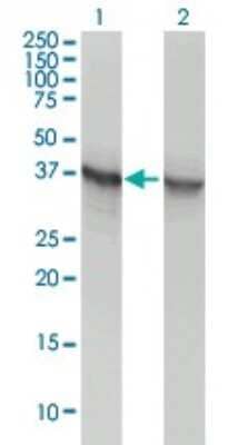 Western Blot: Aldolase A Antibody (3C12-6D11) [H00000226-M02] - Analysis of ALDOA expression in transfected 293T cell line by ALDOA monoclonal antibody (M02), clone 3C12-6D11.Lane 1: ALDOA transfected lysate(39 KDa).Lane 2: Non-transfected lysate.