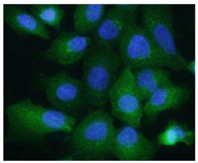 Immunocytochemistry/Immunofluorescence: Aldolase A Antibody (3F9) [NBP2-42620] - Analysis of ALDOA in A549 cells, stained with DAPI (Blue) for nucleus staining and monoclonal anti-human A549 antibody (1:200) with goat anti-mouse IgG-Alexa fluor 488 conjugate (Green).