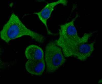 Immunocytochemistry/Immunofluorescence: Aldolase A Antibody (JM54-19) [NBP2-75402] - Staining Aldolase in SK-Br-3 cells (green). The nuclear counter stain is DAPI (blue). Cells were fixed in paraformaldehyde, permeabilised with 0.25% Triton X100/PBS.