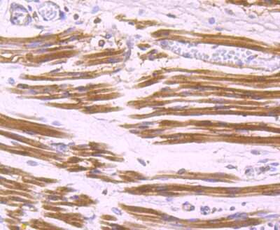 Immunohistochemistry-Paraffin: Aldolase A Antibody (JM54-19) [NBP2-75402] - Analysis of paraffin-embedded human fetal skeletal muscle tissue using anti-Aldolase antibody. Counter stained with hematoxylin.