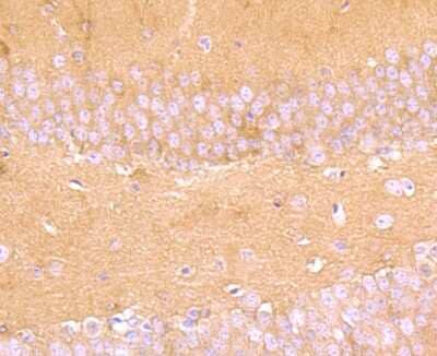 Immunohistochemistry-Paraffin: Aldolase A Antibody (JM54-19) [NBP2-75402] - Analysis of paraffin-embedded mouse brain tissue using anti-Aldolase antibody. Counter stained with hematoxylin.