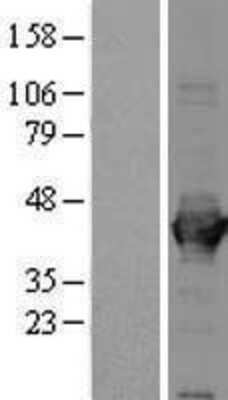 Western Blot Aldolase A Overexpression Lysate